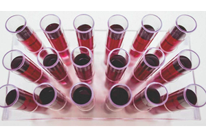 Nieuwe bloedtest onderscheidt verschillende soorten dementie