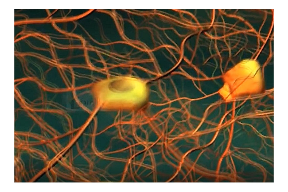 Kan één hersennetwerk verantwoordelijk zijn voor zes verschillende psychiatrische aandoeningen?