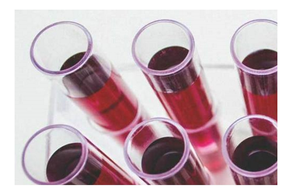 Ontwikkeling bloedtesten voor psychiatrische aandoeningen vordert gestaag